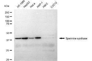 Western blotting analysis using Spermine synthase antibody (ABIN7800420).