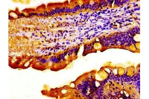 Immunohistochemistry of paraffin-embedded human small intestine tissue using ABIN7175433 at dilution of 1:100
