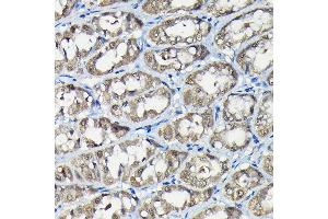 Immunohistochemistry of paraffin-embedded rat stomach using USP5 Rabbit pAb (ABIN1683231, ABIN3018687, ABIN3018688 and ABIN6220542) at dilution of 1:100 (40x lens). (USP5 antibody  (AA 1-280))