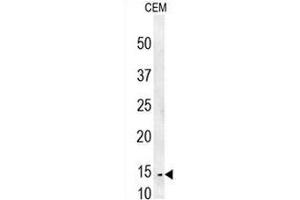 CRCT1 Antibody (N-term) western blot analysis in CEM cell line lysates (35µg/lane). (CRCT1 antibody  (N-Term))