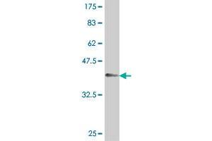 Western Blot detection against Immunogen (37. (CLPTM1 antibody  (AA 151-251))