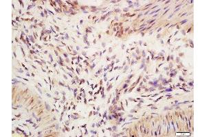 Formalin-fixed and paraffin embedded mouse intestine labeled with Anti-IRF2 Polyclonal Antibody, Unconjugated  at 1:200 followed by conjugation to the secondary antibody and DAB staining (IRF2 antibody  (AA 81-180))