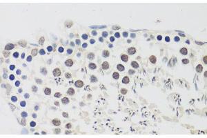 Immunohistochemistry of paraffin-embedded Rat testis using CCNE2 Polyclonal Antibody at dilution of 1:100 (40x lens).