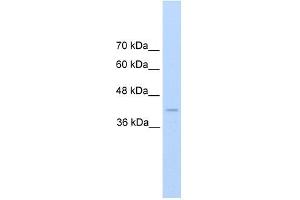 Renin antibody used at 2. (Renin antibody  (C-Term))