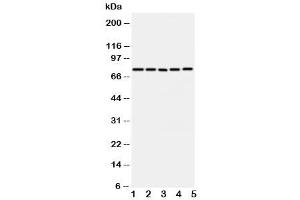 Western blot testing of ABCG1 antibody and Lane 1:  U87 (ABCG1 antibody  (C-Term))