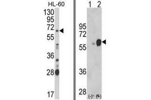 (LEFT) Western blot analysis of ARSB Antibody (Center) in HL-60 cell line lysates (35ug/lane). (Arylsulfatase B antibody  (Middle Region))