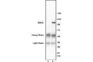 STAT2 antibody (pAb) tested by Immunoprecipitation. (STAT2 antibody  (C-Term))