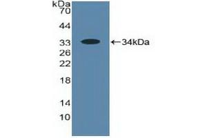 Detection of Recombinant ALOX5, Human using Polyclonal Antibody to 5-Lipoxygenase (5-LO) (ALOX5 antibody  (AA 461-671))