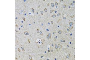 Immunohistochemistry of paraffin-embedded mouse brain using SSBP1 antibody (ABIN5974202) at dilution of 1/100 (40x lens). (SSBP1 antibody)