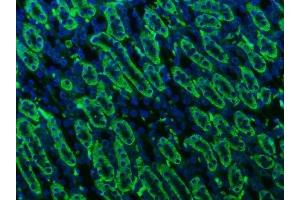 IF analysis of ATP1B1 using anti-ATP1B1 antibody (ABIN7602014).