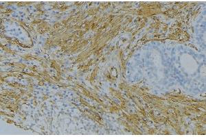 FGF18 antibody  (Internal Region)