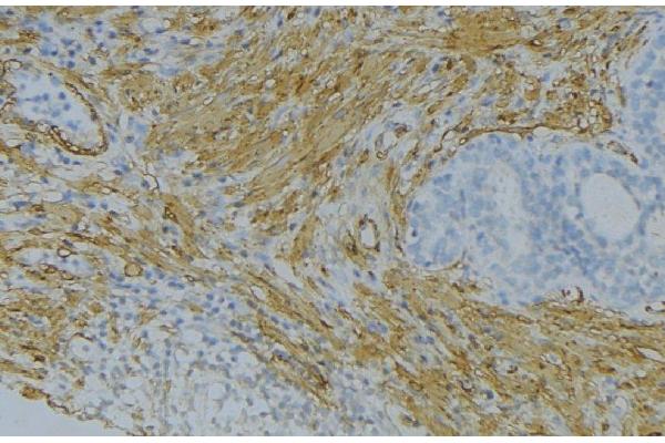 FGF18 antibody  (Internal Region)