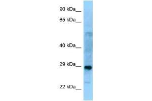 WB Suggested Anti-PROSC Antibody Titration: 1. (PROSC antibody  (C-Term))