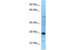 WB Suggested Anti-PROSC Antibody Titration: 1.