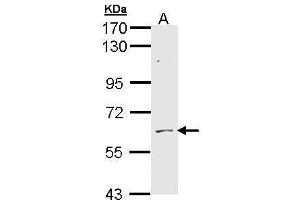 WB Image Sample (30 ug of whole cell lysate) A: H1299 7. (ADCK1 antibody)
