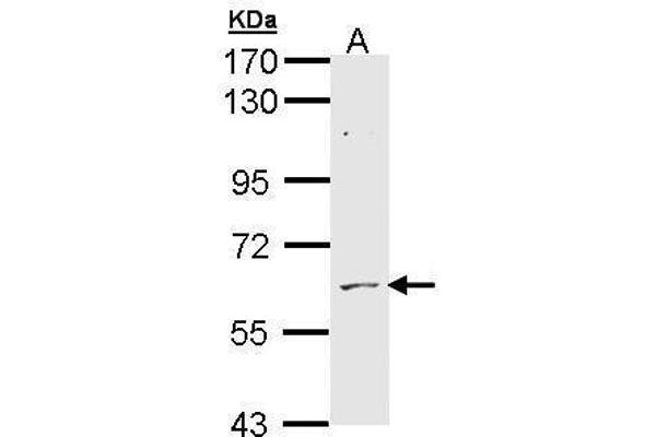 ADCK1 anticorps