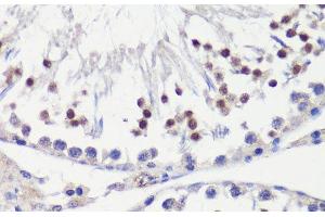 Immunohistochemistry of paraffin-embedded Rat testis using HFM1 Polyclonal Antibody at dilution of 1:100 (40x lens). (HFM1 antibody)