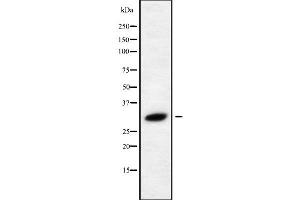 Western blot analysis of RAB40C using HeLa whole cell lysates (RAB40C antibody)