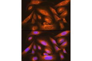 Immunofluorescence analysis of U-2 OS cells using LM Rabbit pAb (ABIN6131613, ABIN6143266, ABIN6143267 and ABIN6214694) at dilution of 1:100 (40x lens). (LMAN1 antibody  (AA 270-480))