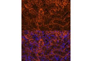 Immunofluorescence analysis of mouse kidney using L Polyclonal Antibody (ABIN6128174, ABIN6143076, ABIN6143077 and ABIN6219002) at dilution of 1:100 (40x lens).