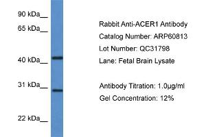 Western Blotting (WB) image for anti-Alkaline Ceramidase 1 (ACER1) (C-Term) antibody (ABIN2788592) (ACER1 antibody  (C-Term))