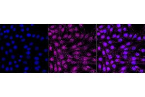 Immunocytochemical staining of C2C12 cells with Phospho-AKT1 (S129) antibody (ABIN7800785), 1:1,000). (Recombinant AKT1 antibody  (pSer129))