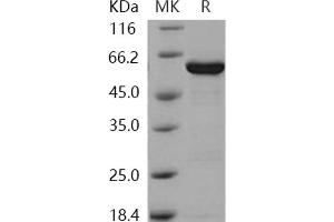 Western Blotting (WB) image for Galactokinase 1 (GALK1) protein (GST tag,His tag) (ABIN7195881) (GALK1 Protein (GST tag,His tag))