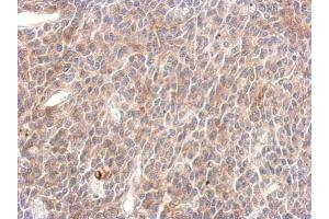 IHC-P Image SHP2 antibody detects PTPN11 protein at cytosol on BT483 xenograft by immunohistochemical analysis. (PTPN11 antibody  (C-Term))
