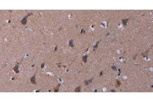 Immunohistochemistry of paraffin-embedded Human brain tissue using TUBGCP2 Polyclonal Antibody at dilution 1:50 (TUBGCP2 antibody)