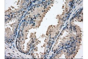 Immunohistochemical staining of paraffin-embedded Human colon tissue using anti-PIM2 mouse monoclonal antibody.