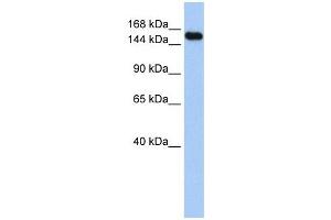 UBE3A antibody used at 1 ug/ml to detect target protein. (ube3a antibody  (Middle Region))