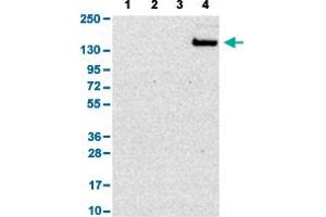 Western Blot analysis with SIGLEC1 polyclonal antibody . (Sialoadhesin/CD169 antibody  (AA 1425-1510))