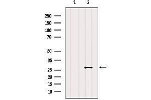 RAB20 antibody  (Internal Region)