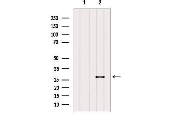 RAB20 antibody  (Internal Region)