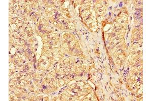 Immunohistochemistry of paraffin-embedded human adrenal gland tissue using ABIN7158780 at dilution of 1:100 (CTSA antibody  (AA 30-327))