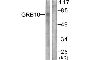 Immunohistochemistry analysis of paraffin-embedded human brain tissue using GRB10 (Ab-67) antibody. (GRB10 antibody)