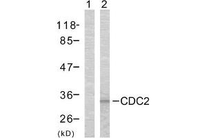 Western blot analysis of the extracts from COLO cells using CDC2 (Ab-161) antibody (E021152).