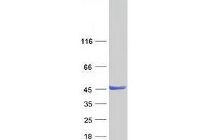 Validation with Western Blot (ZADH2 Protein (Myc-DYKDDDDK Tag))