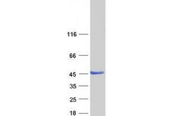 ZADH2 Protein (Myc-DYKDDDDK Tag)