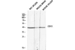 Western Blot (WB) analysis of Rat Spleen Mouse Brain Mouse Spleen lysis using CD72 antibody. (CD72 antibody)