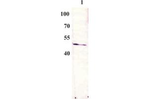 Western Blot testing of anti-BPV E2 monoclonal antibody (3F12). (Bovine Papilloma Virus 1 E2 (BPV-1 E2) (AA 197-208) antibody)