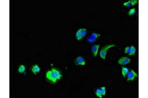 Immunofluorescent analysis of MCF-7 cells using ABIN7154264 at dilution of 1:100 and Alexa Fluor 488-congugated AffiniPure Goat Anti-Rabbit IgG(H+L) (GPC1 antibody  (AA 342-530))