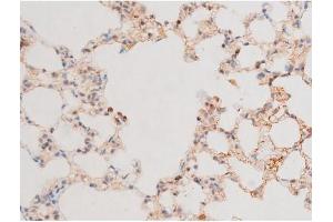 Immunohistochemistry (IHC) image for anti-GATA Binding Protein 4 (GATA4) (pSer262) antibody (ABIN6256227)