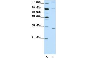 WB Suggested Anti-ATOH8 Antibody Titration:  2. (ATOH8 antibody  (N-Term))