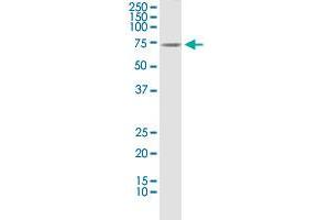 CLU monoclonal antibody (M01), clone 1A11. (Clusterin antibody  (AA 402-501))