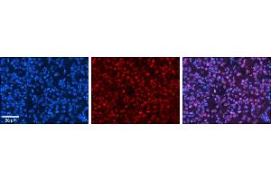 Rabbit Anti-HIPK2 Antibody     Formalin Fixed Paraffin Embedded Tissue: Human Pineal Tissue  Observed Staining: Nuclear in pinealocytes & intersticial cells  Primary Antibody Concentration: 1:100  Other Working Concentrations: 1/600  Secondary Antibody: Donkey anti-Rabbit-Cy3  Secondary Antibody Concentration: 1:200  Magnification: 20X  Exposure Time: 0. (HIPK2 antibody  (Middle Region))