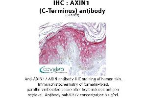 Image no. 1 for anti-Axin 1 (AXIN1) (C-Term) antibody (ABIN1732155)