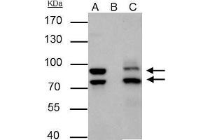 IP Image MDM2 antibody immunoprecipitates MDM2 protein in IP experiments. (MDM2 antibody  (Center))