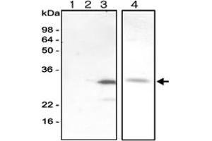 Western blot analysis of recombinant human AK isozymes. (Adenylate Kinase 3 antibody)