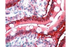 Image no. 1 for anti-Fatty Acid Binding Protein 2, Intestinal (FABP2) (C-Term) antibody (ABIN374817) (FABP2 antibody  (C-Term))